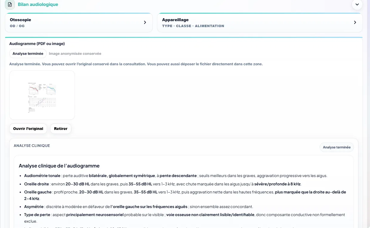 Module d’analyse d’audiogramme dans Aude